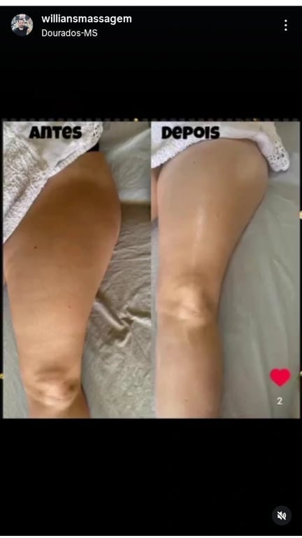 Mídia 1